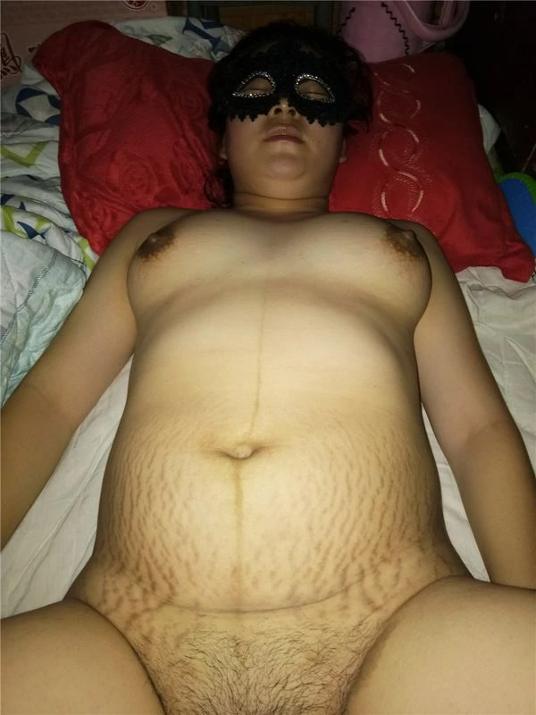 生完孩子的少妇肚子上的这看着真心疼[16P]
