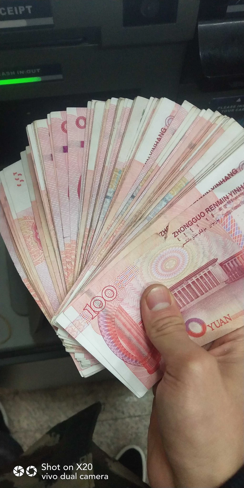 包皮不长的