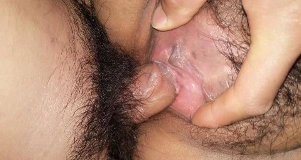 黑木耳 [15P]